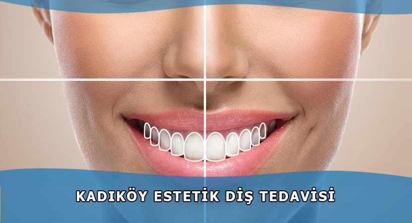 Kadıköy Estetik Diş Tedavisi İstanbul